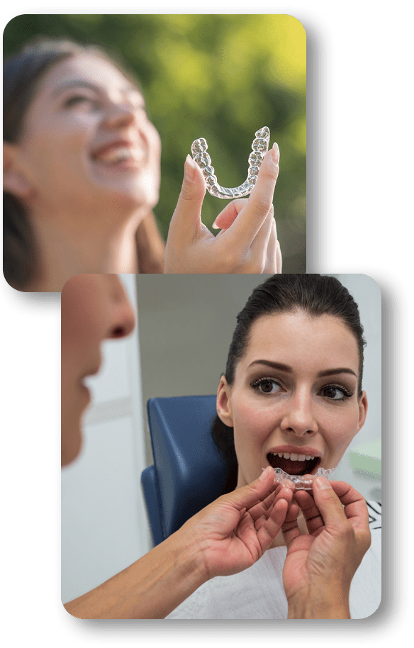 Invisalign-big_03-min