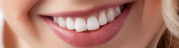 Teeth-Whitening1_03-min