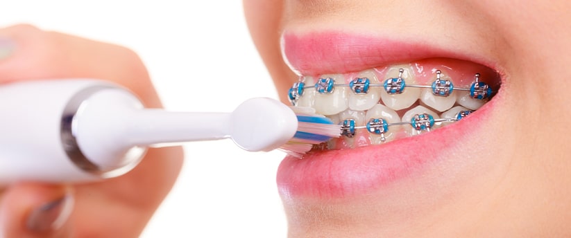 Brushing with braces on