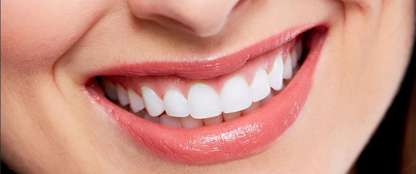 What do you know about veneers?