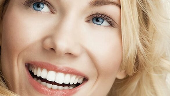 Transform Your Smile with a Hollywood Smile Makeover at The Dental Boutique Clinic, JLT Dubai